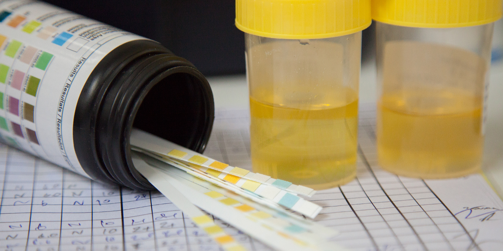 Myth 10: You can store or &ldquo;pre-pass&rdquo; urine for later